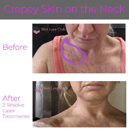 Explore history tattoo ideas, creative tattoo ideas in Bayside, available at Laser Goddess