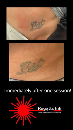 Explore tattoo arm sleeve ideas woman, creative tattoo ideas in Morrisville, available at Regerts Ink Removal