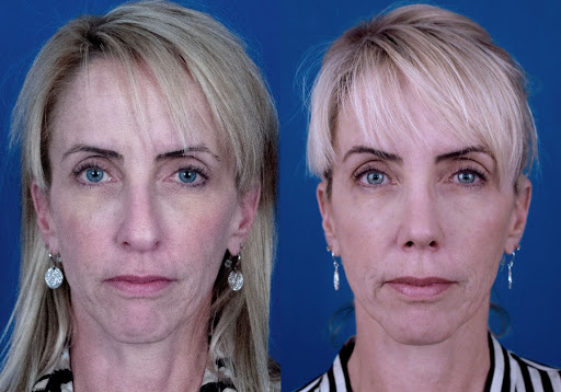 Bella Vista ENT & Facial Plastic Surgery