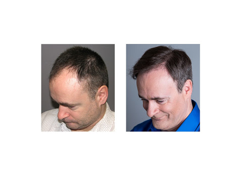 Hair Transplantation Clinic «Bosley Medical - Seattle», reviews and photos, 2505 2nd Ave #715, Seattle, WA 98121, USA