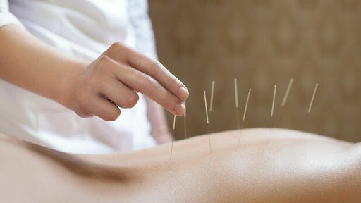 Acupuncture weight loss clinics Puebla