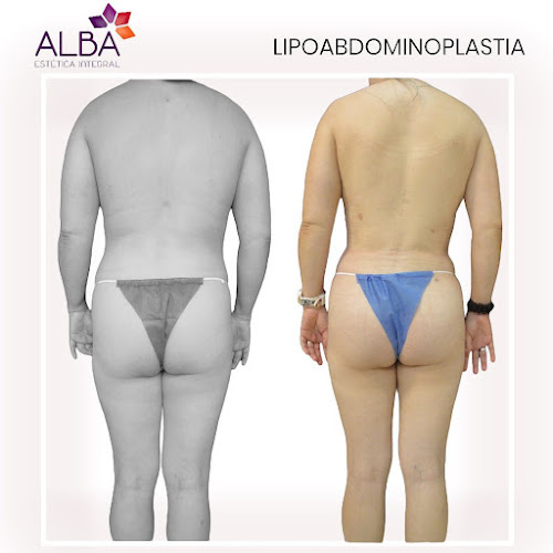 Opiniones de CLINICA ESTETICA ALBA en Machala - Centro de estética
