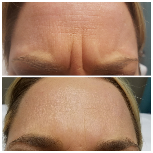 Medical Spa «Premier Med Spa & Weight Loss», reviews and photos, 2001 N Collins Blvd #105, Richardson, TX 75080, USA