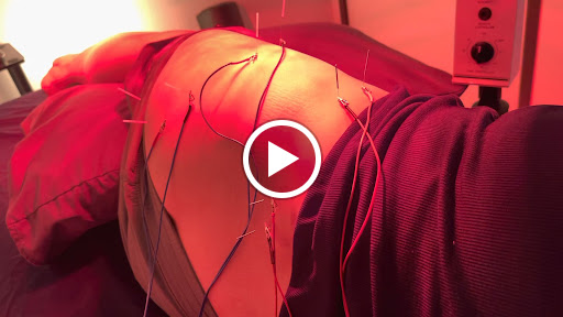Stress Free Acupuncture Steve i. Han, LAc. image
