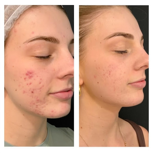 Explore d20 tattoo ideas, creative tattoo ideas in Princeton Junction, available at Princeton Aesthetics