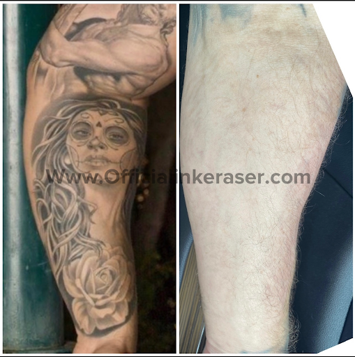 Explore finger tattoo cover up ideas, creative tattoo ideas in Scottsdale, available at The INK Eraser