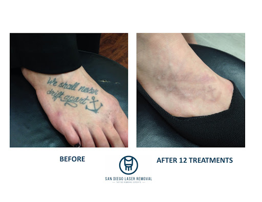 Explore birthday year tattoo ideas, creative tattoo ideas in San Diego, available at Removery Tattoo Removal & Fading