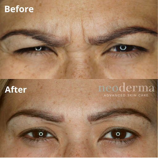 Find best meaningful tattoo ideas for your next unique tattoo in Anaheim at Neoderma