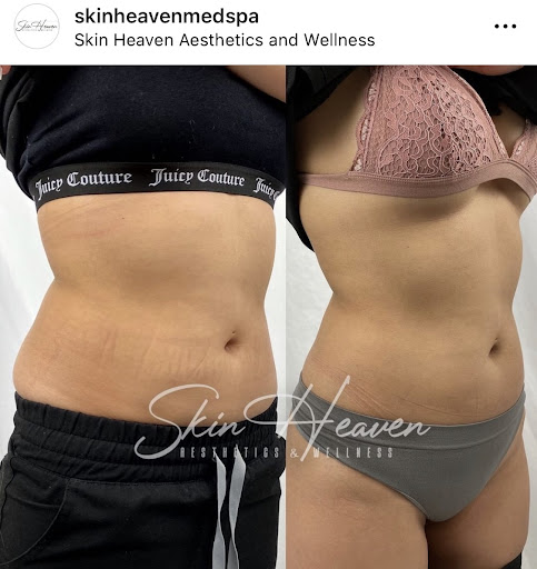 Skin Heaven Aesthetics and Wellness image