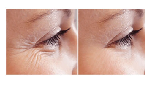 Explore pisces symbol tattoo ideas, creative tattoo ideas in Summit, available at Ethos Aesthetics and Wellness, Laser Hair Removal and Med Spa