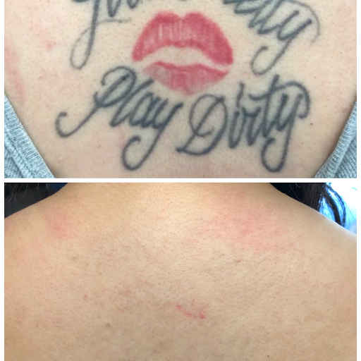 Explore forearm half sleeve cover up tattoo ideas, creative tattoo ideas in San Antonio, available at MEDermis Tattoo Removal