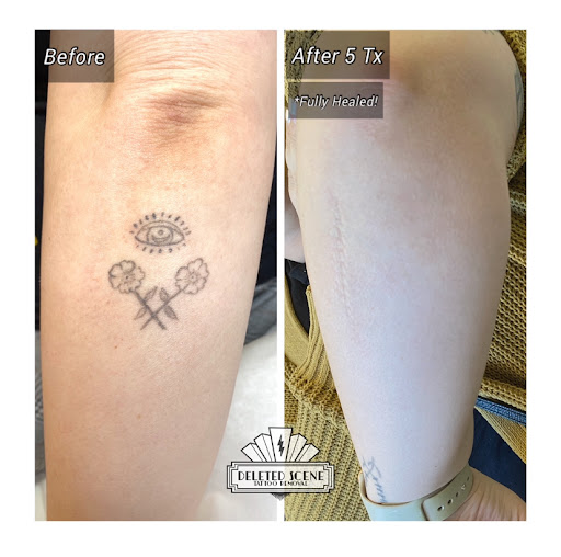 Explore wifes name tattoo ideas, creative tattoo ideas in Hatboro, available at Deleted Scene Tattoo Removal