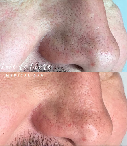 Find simple small tattoo ideas for your next unique tattoo in Canton at JDV Med Spa