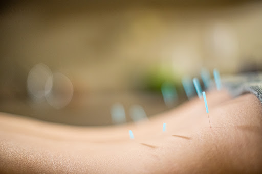Alethea Healing Acupuncture