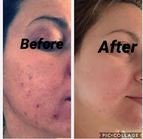 Skincare By Cora - Photo 7 - Car repair in Oceanside, CA, Oceanside