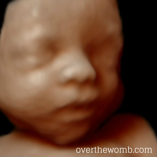 Over the Womb 4D Ultrasound & Photography