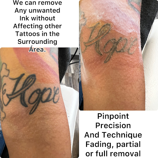 Explore family tree tattoo ideas with names, creative tattoo ideas in New York, available at Ag2g Laser Tattoo Removal & MedSpa