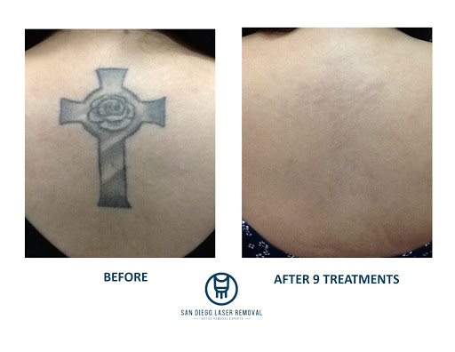 Find freemason tattoo ideas for your next unique tattoo in San Diego at Removery Tattoo Removal & Fading