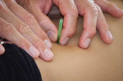 Mill-e-Moto: Acupuncture