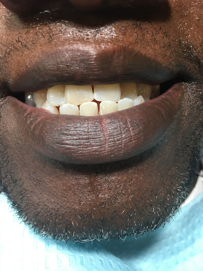 A1smile teeth whitening