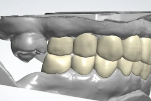 Smile Confident Dentistry (Dental clinic, dentist, RCT, Dental Braces, Extraction image