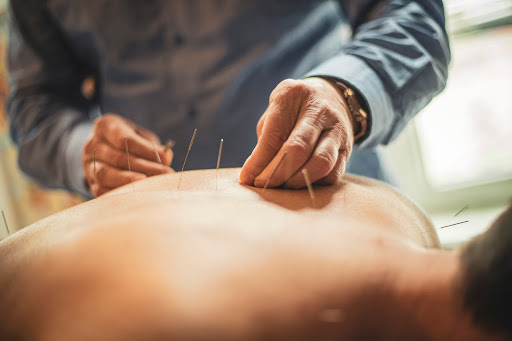 Dr Acupuncture