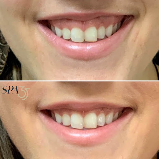 Explore jet tattoo ideas, creative tattoo ideas in Boise, available at Spa 35 Med Spa