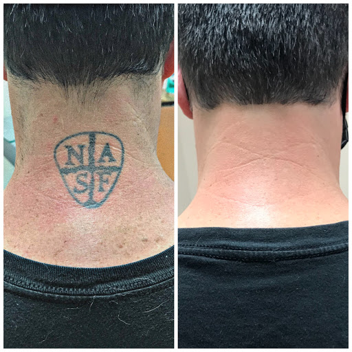 Explore tattoo ideas hunting, creative tattoo ideas in Pinellas Park, available at St Pete Tattoo Removal