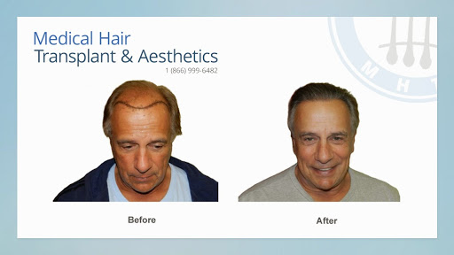 Hair Replacement Service «Medical Hair Transplants & Aesthetics», reviews and photos, 15055 Los Gatos Blvd Suite #110, Los Gatos, CA 95032, USA