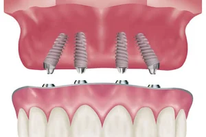 Partners Dentures and Implants image
