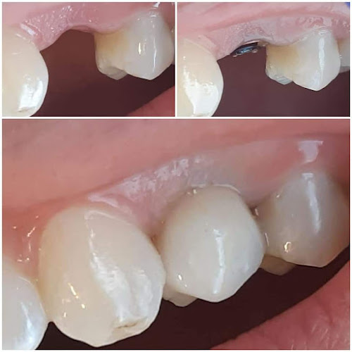 ⁩ ⁩ ⁩ ⁩ ⁩ ⁩ ⁩ ⁩ ⁩ ⁩ ⁩ ⁩ מרפאת שיניים ד''ר עטון חירום ירושלים / Emergency Dental Clinic Dr Atoun Jerusalem
