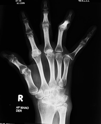 Baja Hand Clinic