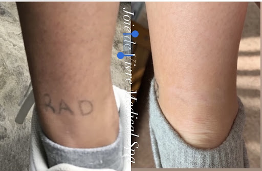 Find long distance best friend tattoo ideas for your next unique tattoo in Canton at JDV Med Spa