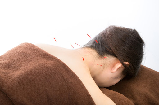 Shizue Hayashi Ito Acupuncture (Inside Best Chiropractic)