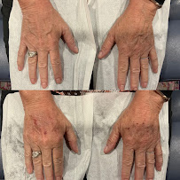 Caren Az Beauty Injector - Photo 3 - Car repair in Chandler, AZ, Chandler