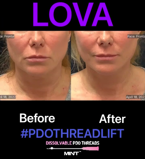 Explore unique tattoo ideas for moms, creative tattoo ideas in Lake Oswego, available at Lake Oswego Vein and Aesthetic LOVA