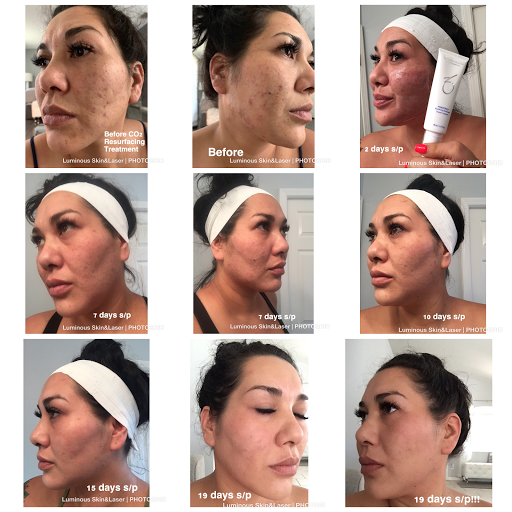 Find cute tattoo ideas for best friends for your next unique tattoo in Tampa at Luminous Skin and Laser