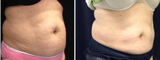 Laser Hair Removal Service «All Care Laser Center», reviews and photos, 820 Turnpike St, North Andover, MA 01845, USA