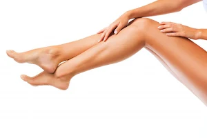 Laser hair removal by Carly image