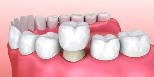 Dentista Chihuahua BS Consultorio Dental