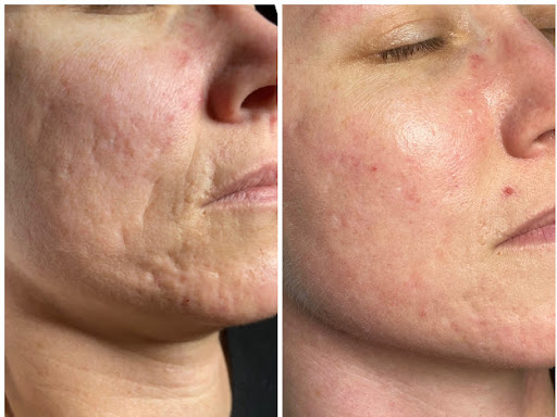 Explore bell tattoo ideas, creative tattoo ideas in Savannah, available at Haute Brows. Cosmetic Tattoo