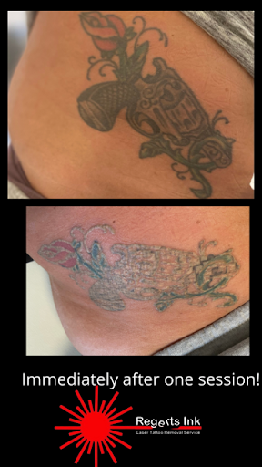Explore sunlight tattoo ideas, creative tattoo ideas in Morrisville, available at Regerts Ink Removal
