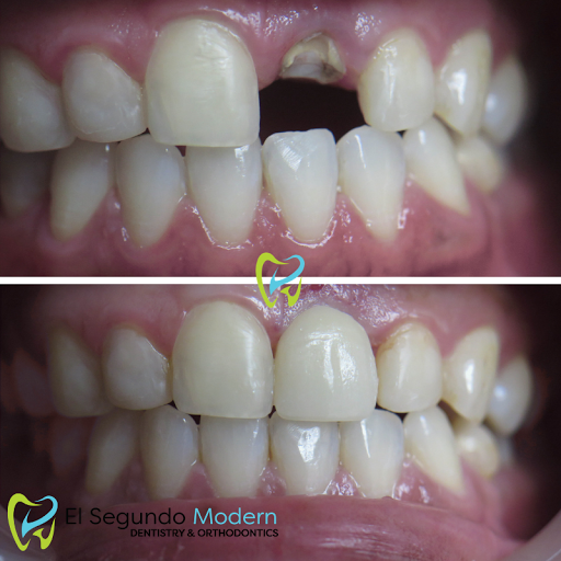 El Segundo Modern Dentistry image