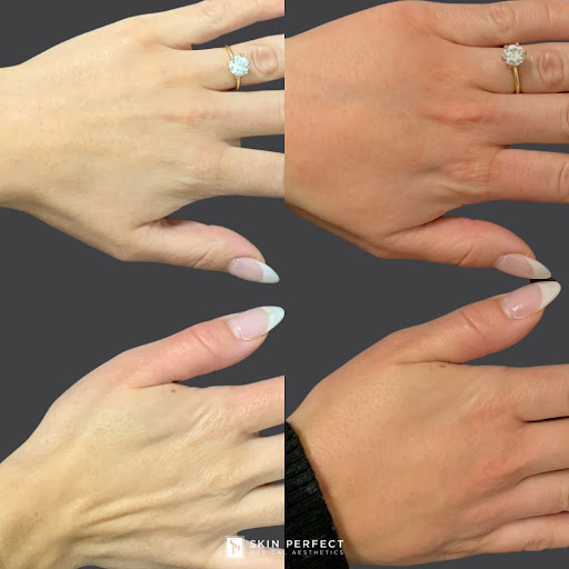 Explore supernatural tattoo ideas, creative tattoo ideas in Whittier, available at Skin Perfect Medical Aesthetics