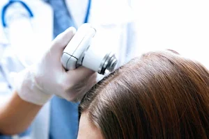 Dr. Rekha Yadav's Revital Trichology/Hair loss/PRP/Mesotherapy/ GFC/ HGFT/Glutathione/IV Therapies skin,hair & detox image