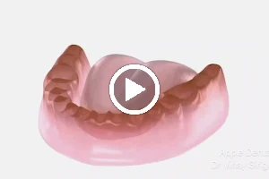 APPLE DENTAL Clinic In Vijayanagar | Orthodontics & Oral Rehabilitation | TMJ Disorders & Pain Management | Root Canal Rx | image