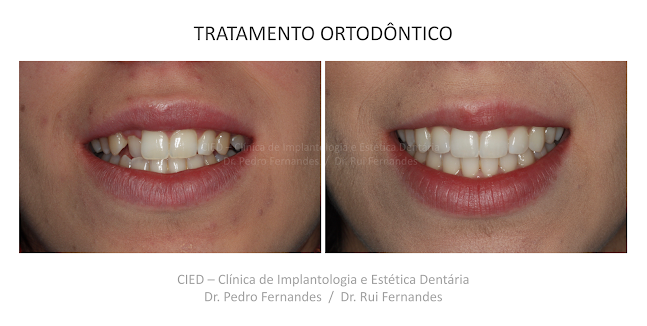 CIED - Clínica de Implantologia e Estética Dentária - Penafiel