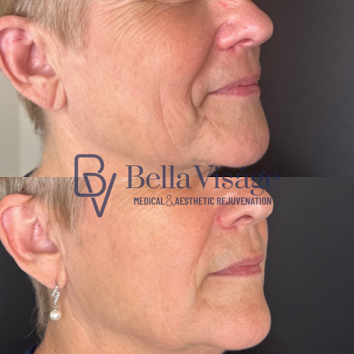 Explore japanese tattoo ideas, creative tattoo ideas in Lakeland, available at Bella Visge Medical & Aesthetic Rejuvenation