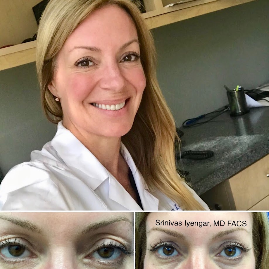 San Diego Eyelid Specialists