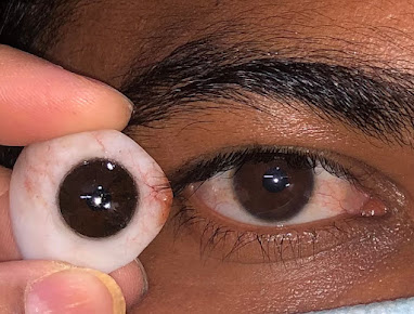 Chinmaya Artificial Eye Clinic - Chinmaya Artificial Eye Clinic